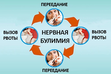 Лечение булимии в Нюрбе